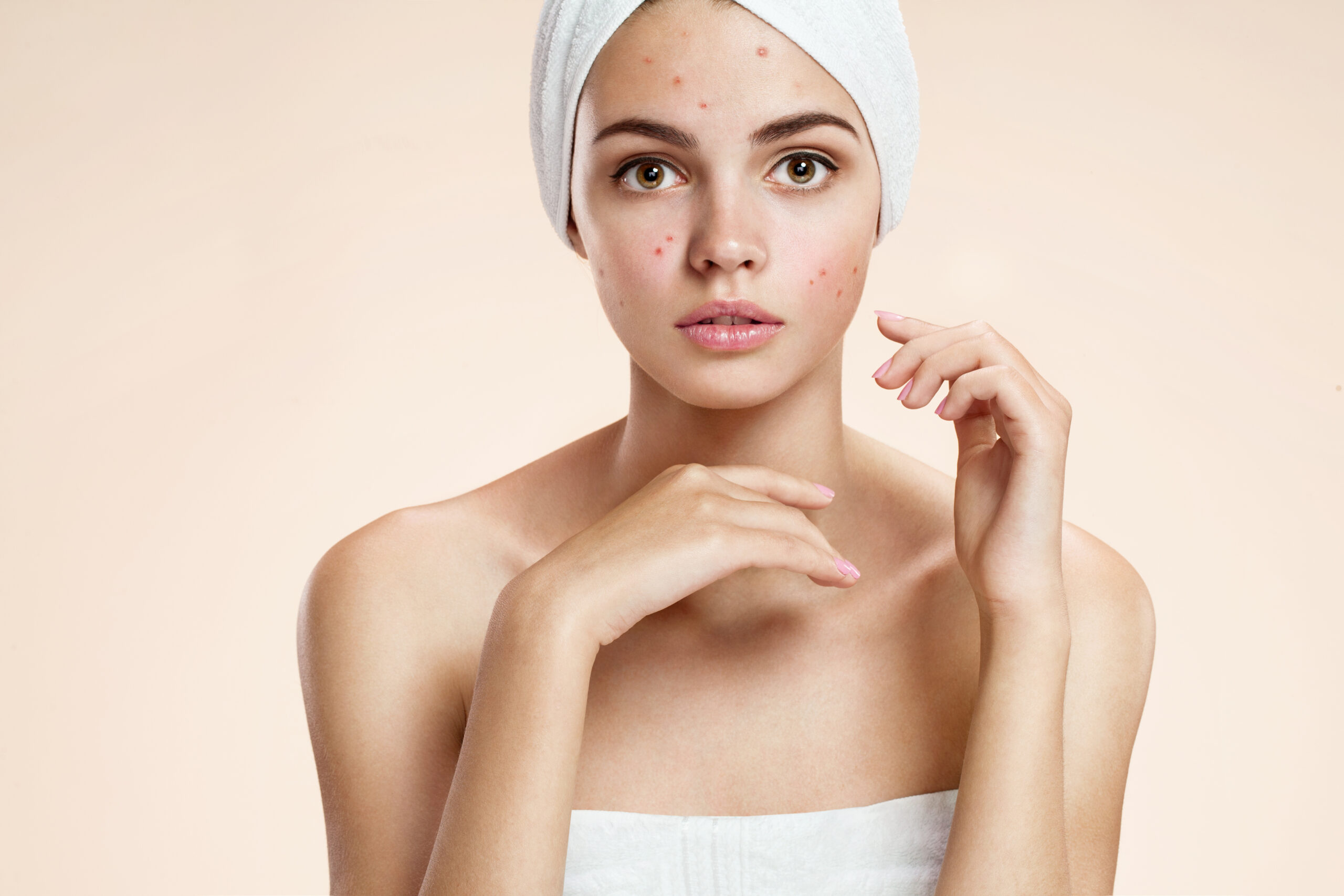 Top 10 Effective Treatments for Hyperpigmentation in Northbrook, IL | Derm Collective North Shore